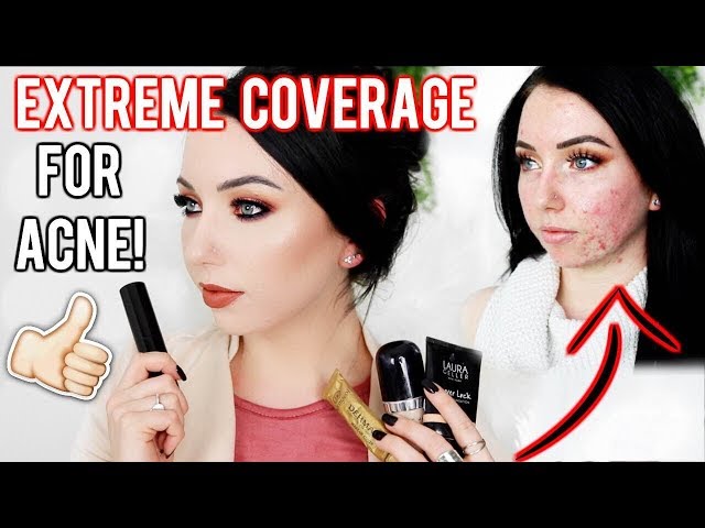 MY TOP FOUNDATIONS FOR ACNE & TEXTURED SKIN! Full/Extreme Coverage Makeup | Fair Skin