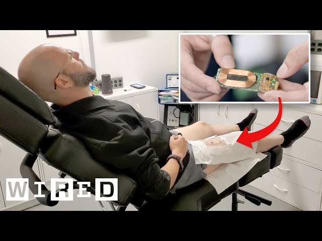 Biohacker Explains Why He Turned His Leg Into a Hotspot | WIRED
