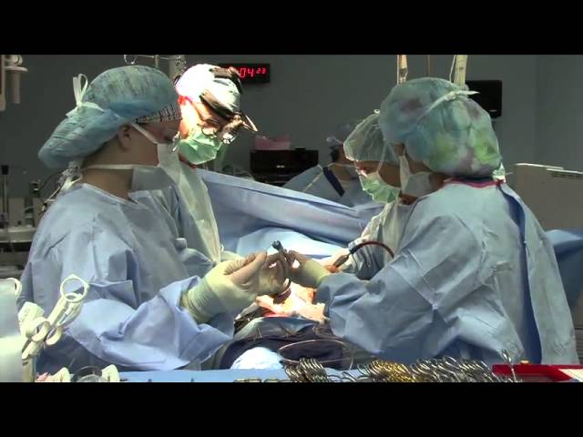 Minimally invasive heart valve surgery video in Cedar Rapids, Iowa