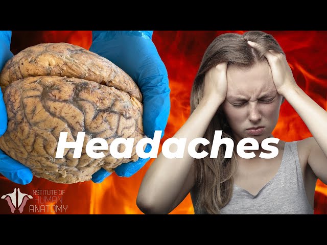 What is Causing Your Headaches?