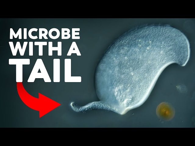 This Microbe Hasn't Been Seen Since The 1930s