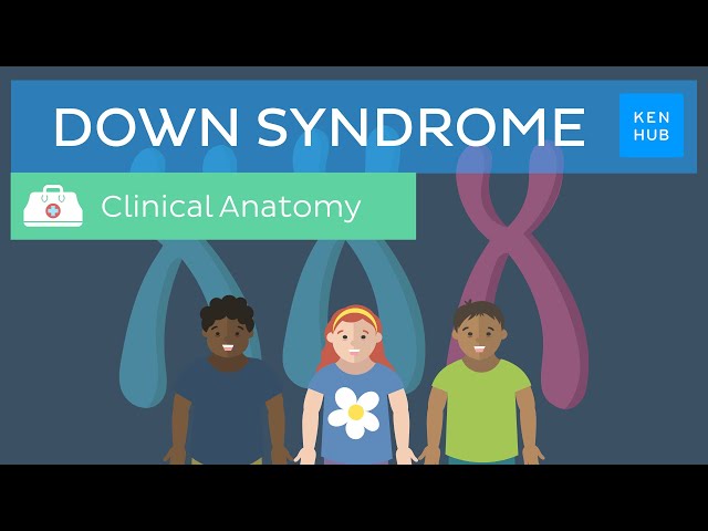 Down Syndrome: Definition, causes, symptoms, diagnosis  | Kenhub