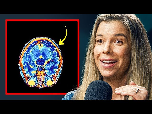 How To Stop Getting Brain Fog All The Time - Dr Rhonda Patrick