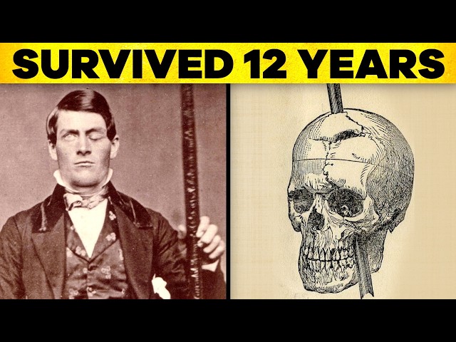 People Who Somehow Survived Freak Accidents